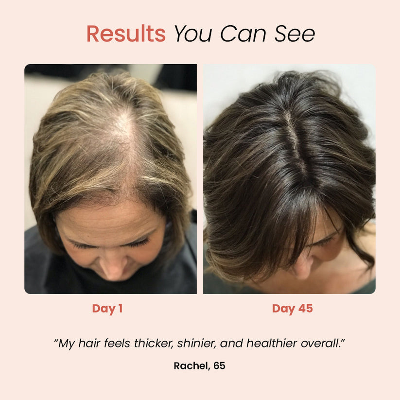 LumiGrow™: Feel the Confidence in Youthful, Thicker Hair